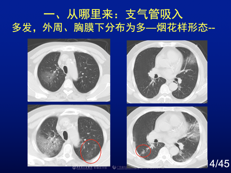 新疆新冠肺炎最早信息的深度探究与解析